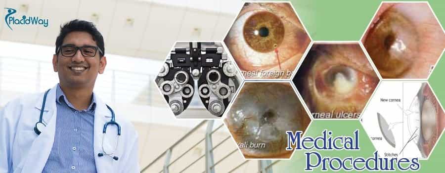 Eye Surgery in Delhi, India
